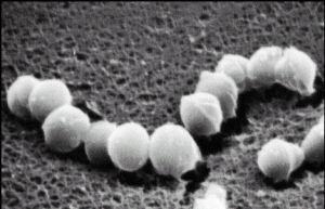 劇症型Ａ群連鎖球菌の電子顕微鏡写真（愛知県衛生研究所のＨＰより）