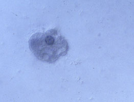 amoeba1