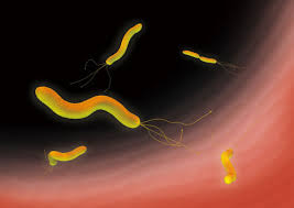 ピロリ菌は鞭毛が長いのが特徴！